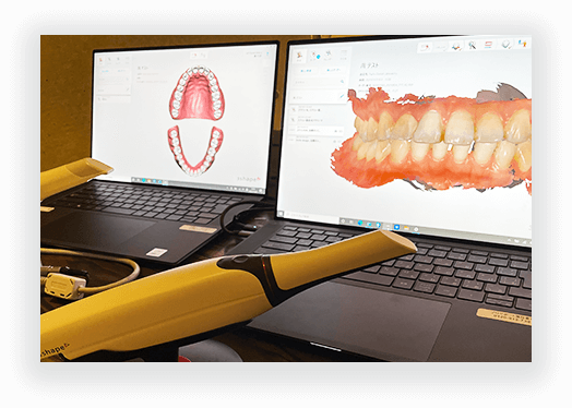 口腔内スキャナーの写真